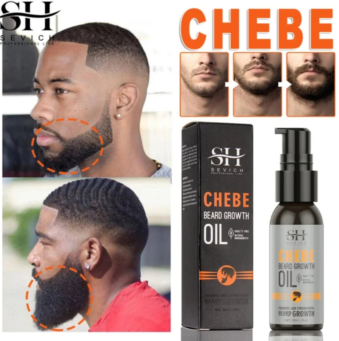 Chebe l'huile repousse barbes