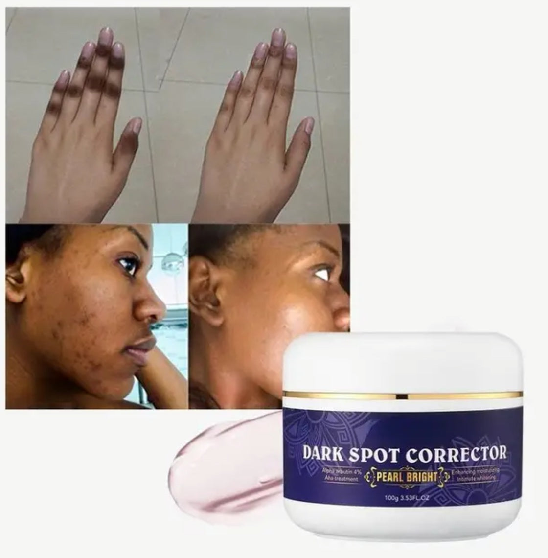 Crème correcteur des points noir  Dark spots corrector